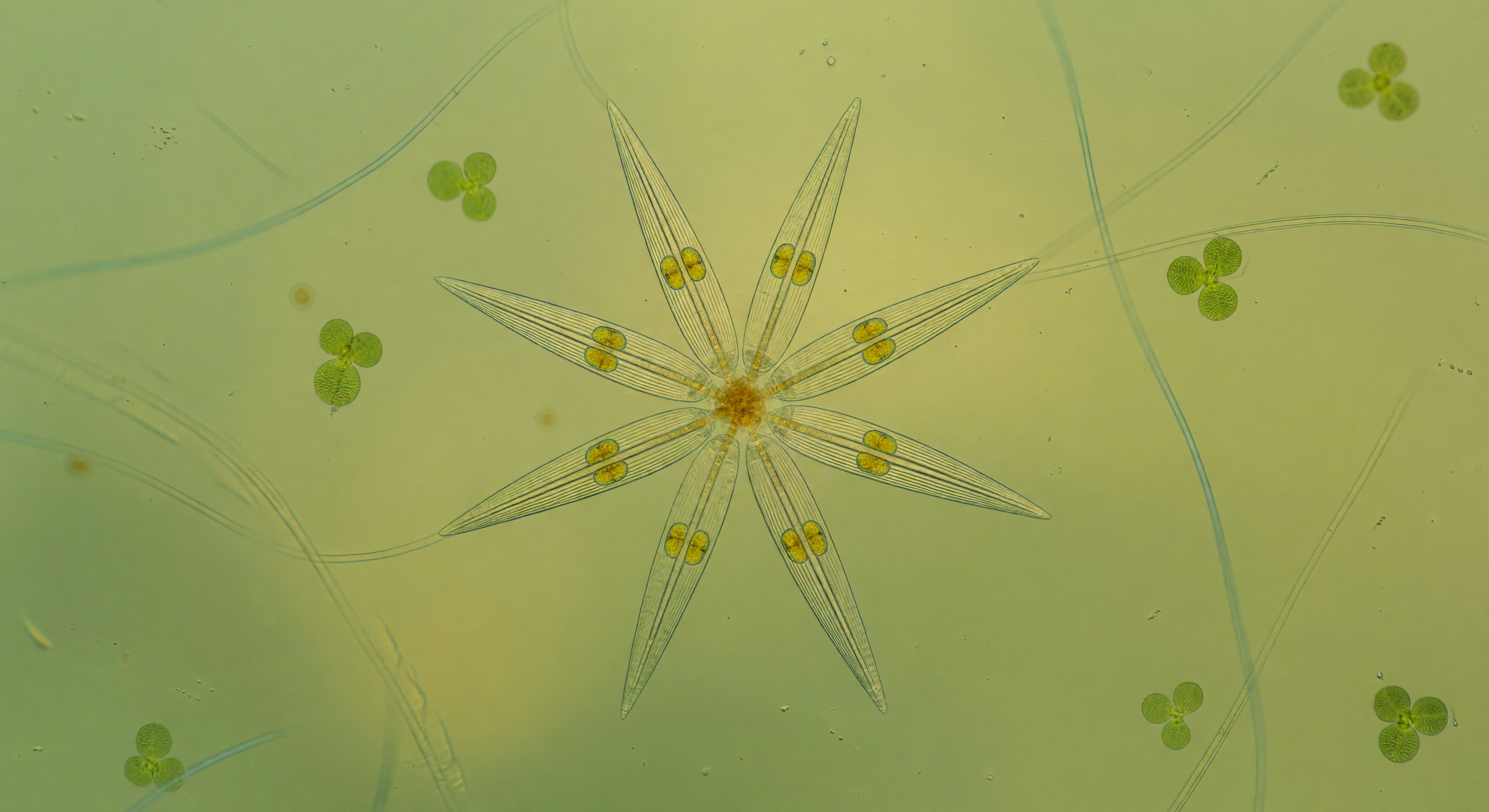 Asterionella Sternkolonie Süßwasser
